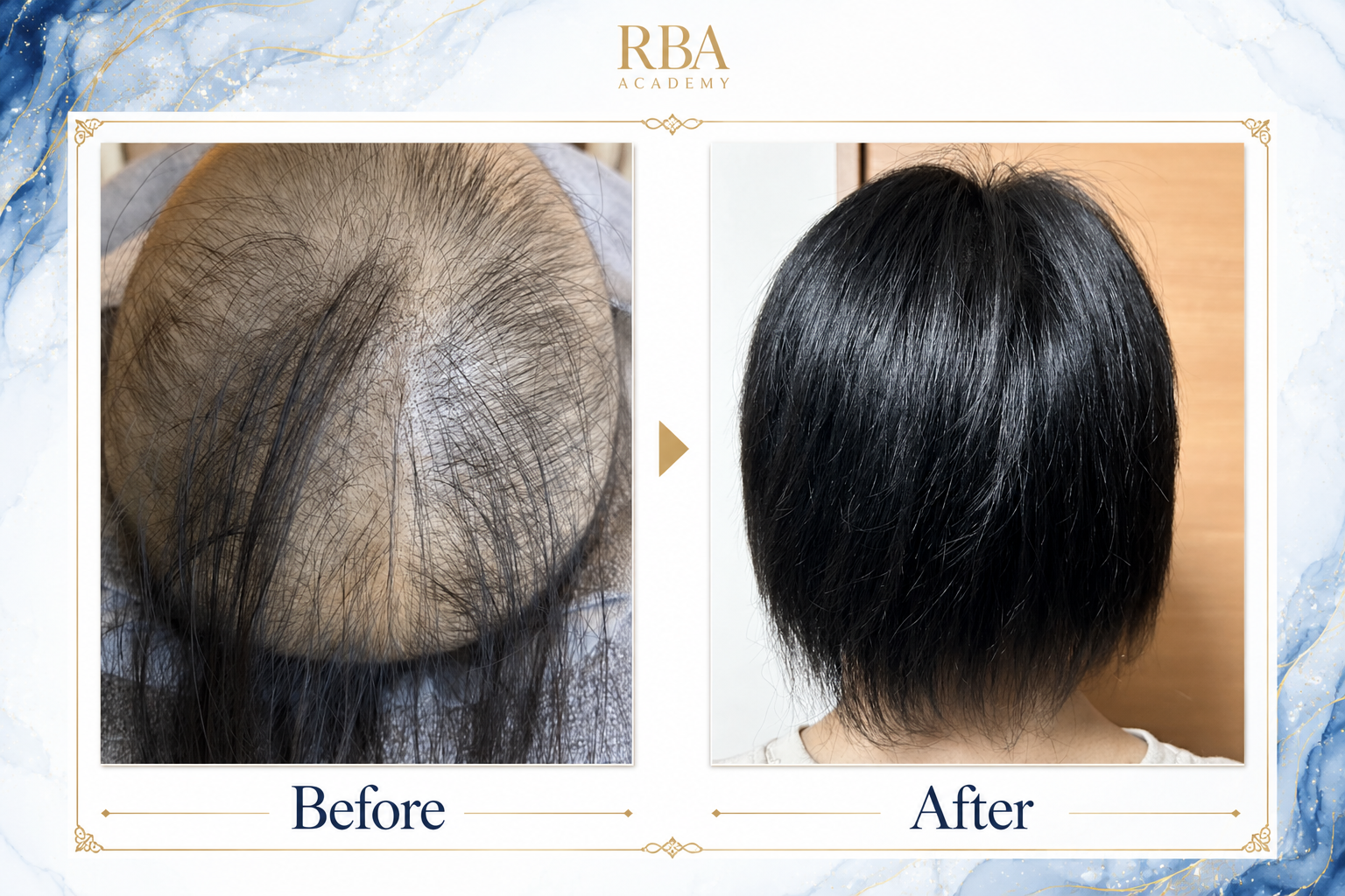 RBA3期生 ビフォーアフター事例2