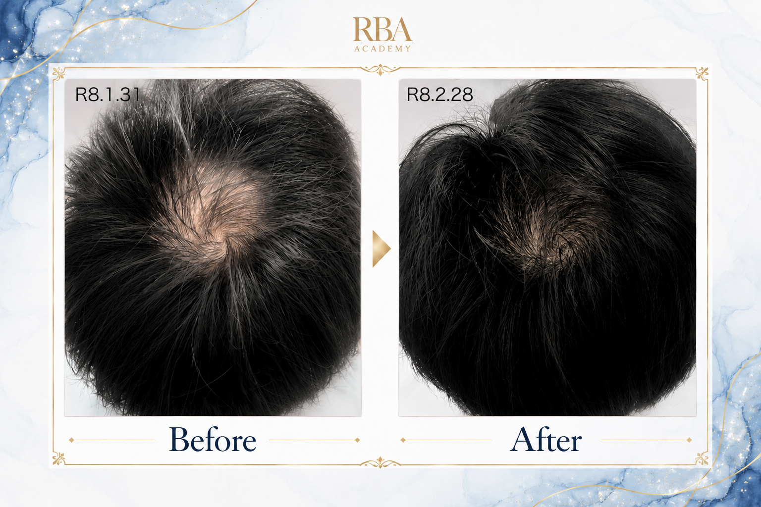 RBA3期生 ビフォーアフター