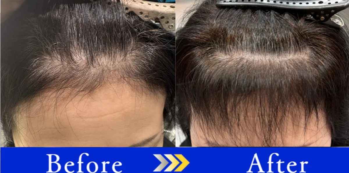 みさこさんがサポートしたお客様のビフォーアフター